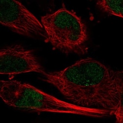 C10orf55 Antibody, Novus Biologicals 25 &mu;L; Unlabeled:Antibodies, Polyclonal
